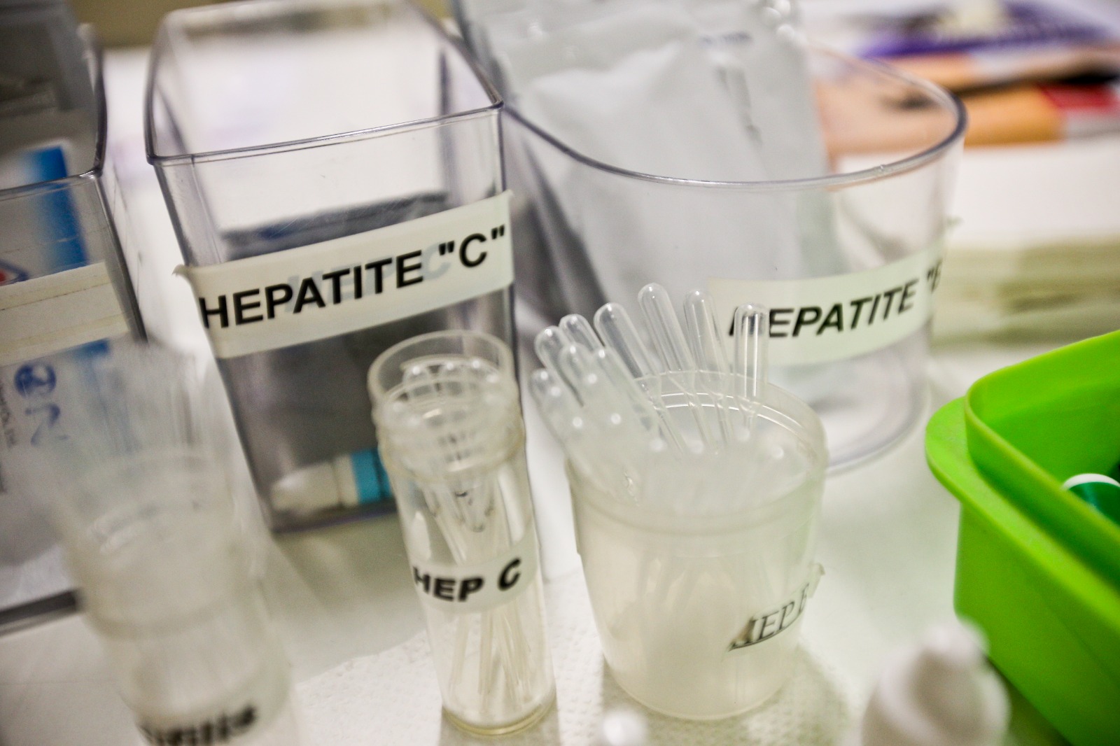 Casos de hepatite Delta acendem o alerta da saúde no Amazonas 